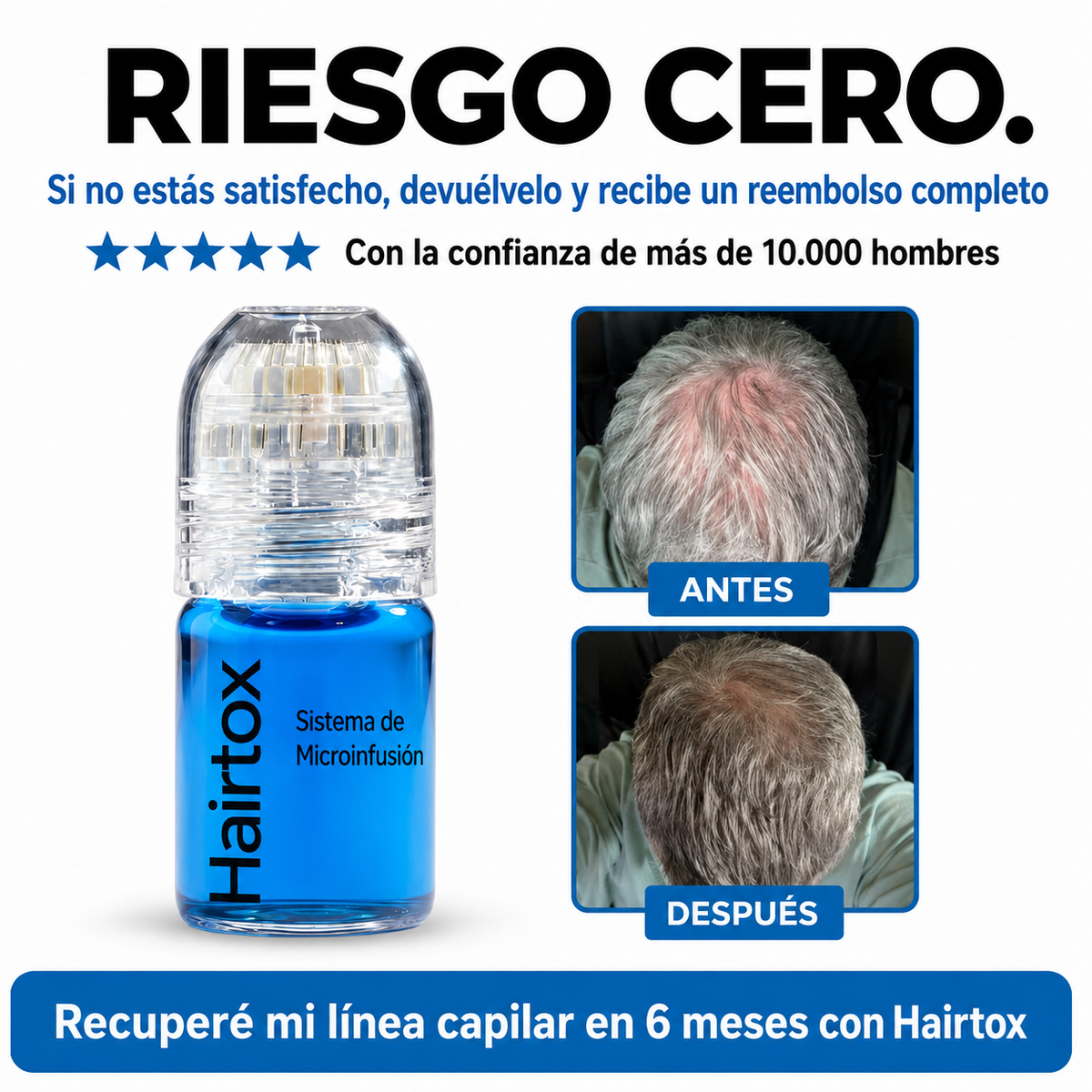 El sistema de infusión de péptidos más potente para el crecimiento del cabello